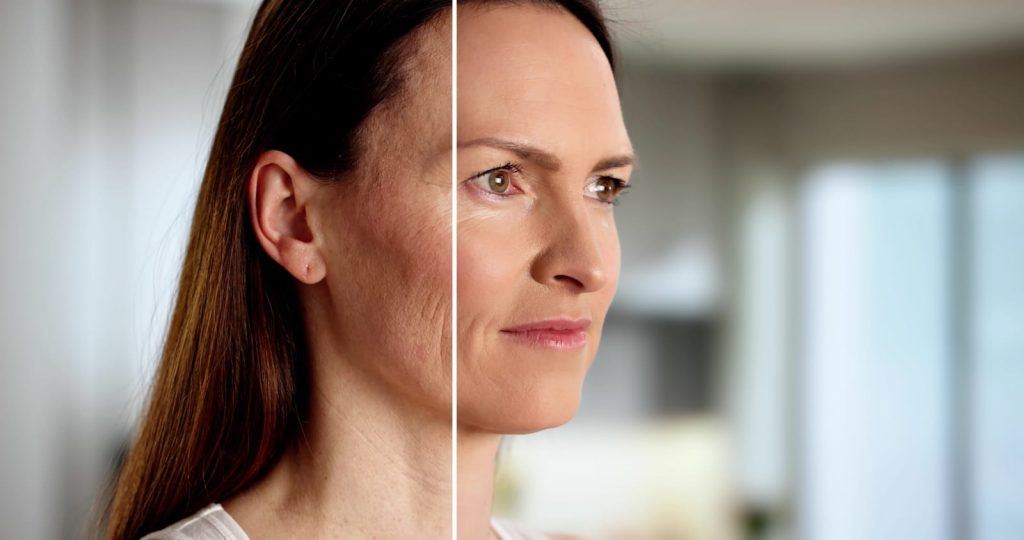 膠原蛋白減少臉部皺紋